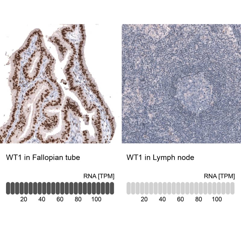 Analysis in human fallopian tube and lymph node tissues using NBP3-44378 antibody. Corresponding WT1 RNA-seq data are presented for the same tissues.
