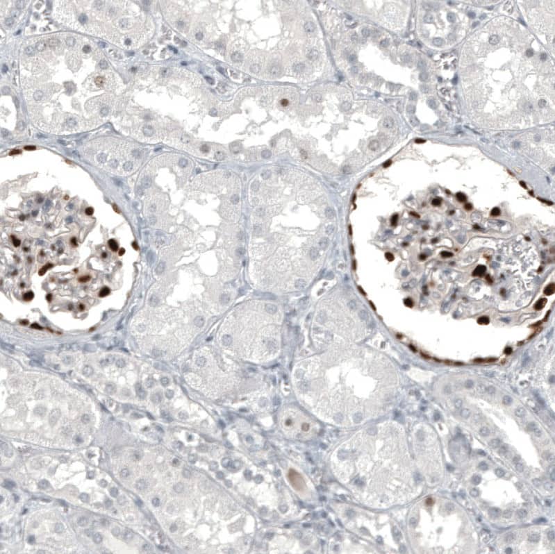 Staining of human kidney shows strong nuclear positivity in cells in glomeruli.