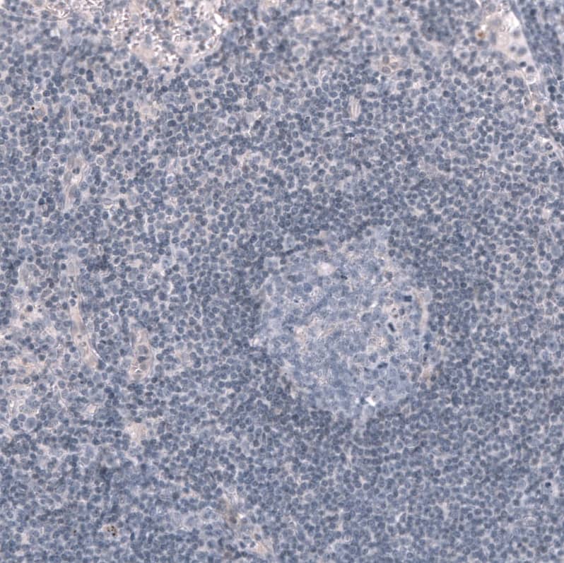 Staining of human lymph node shows no positivity in germinal center cells as expected.