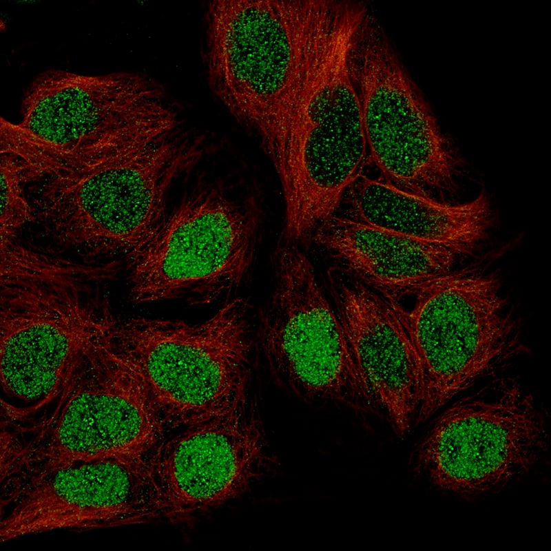 Staining of CACO-2 cells using the Anti-WT1 monoclonal antibody) .
