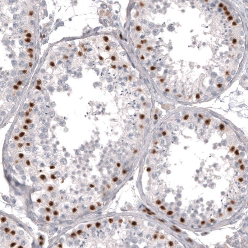 Staining of human testis shows strong nuclear positivity in cells in seminiferous ducts.