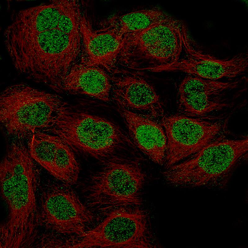 Staining of CACO-2 cells using the Anti-WT1 monoclonal antibody) .