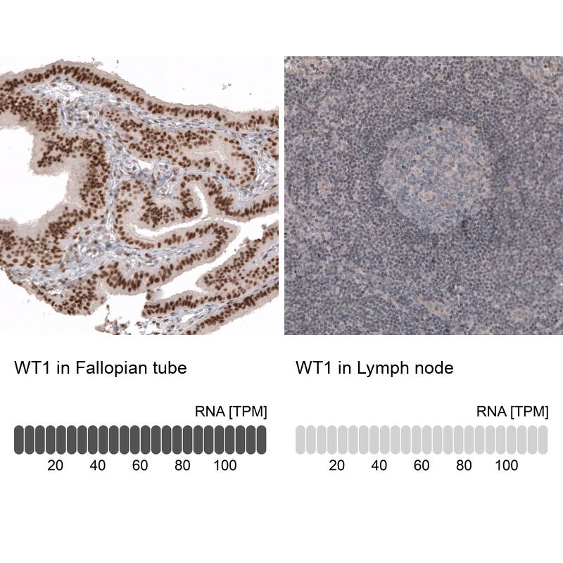 Analysis in human fallopian tube and lymph node tissues using NBP3-44379 antibody. Corresponding WT1 RNA-seq data are presented for the same tissues.