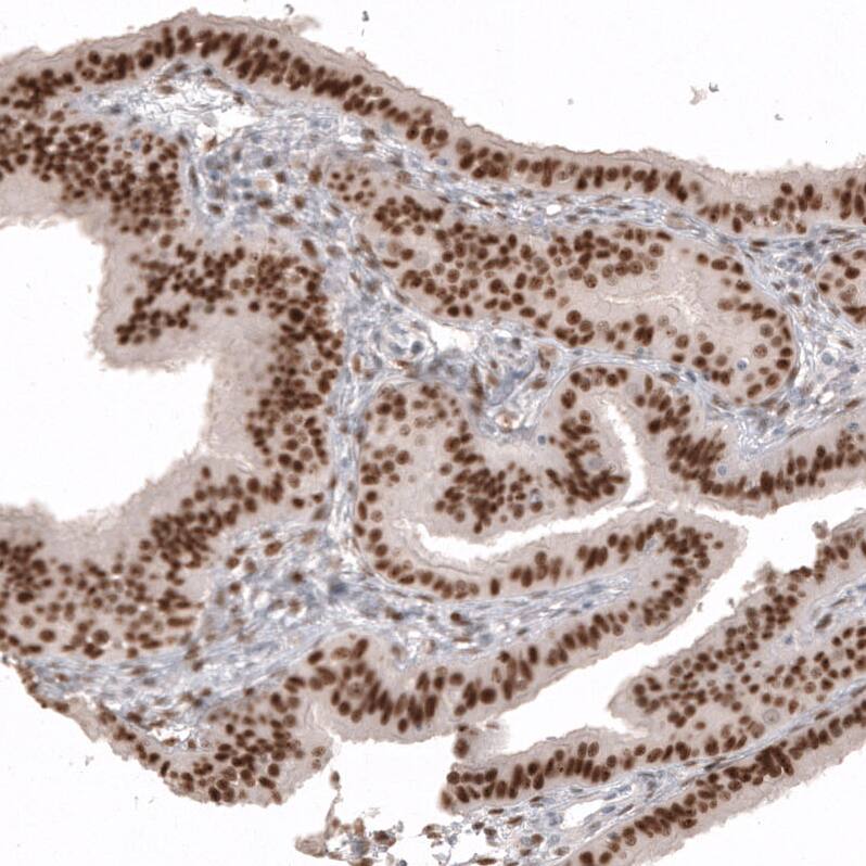 Staining of human fallopian tube shows strong nuclear positivity in glandular cells.