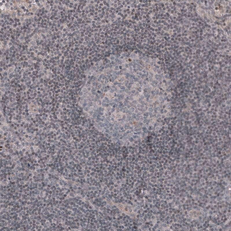 Staining of human lymph node shows no positivity in germinal center cells as expected.