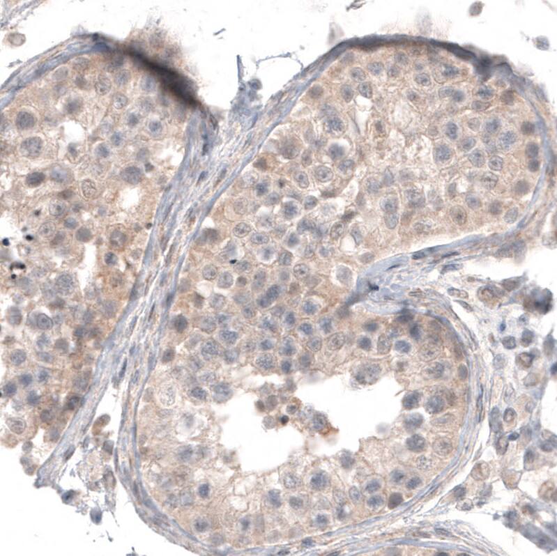 Staining of human testis shows weak membranous and cytoplasmic positivity in cells in seminiferous ducts.