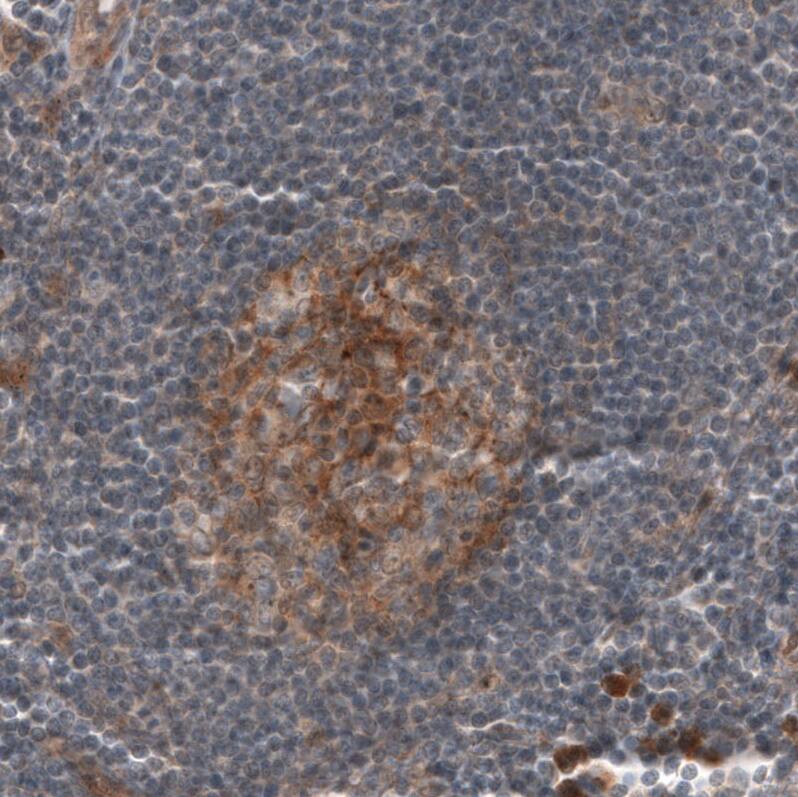 Staining of human tonsil shows moderate membranous positivity in germinal center cells.