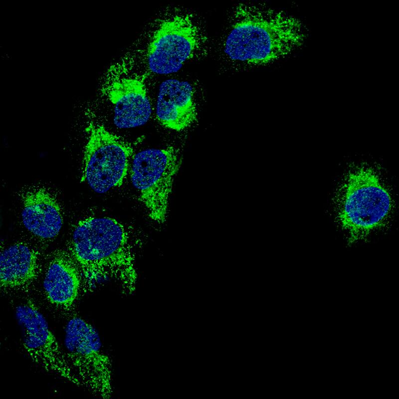 Staining of A-431 cells using the Anti-PBR monoclonal antibody) .