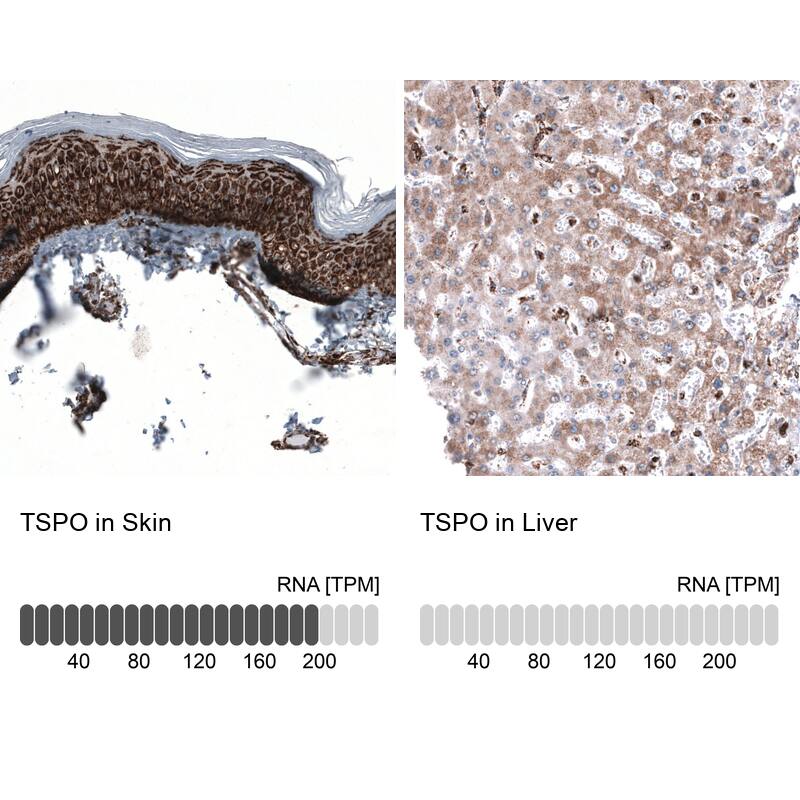 Analysis in human skin and liver tissues using NBP3-44381 antibody. Corresponding PBR RNA-seq data are presented for the same tissues.
