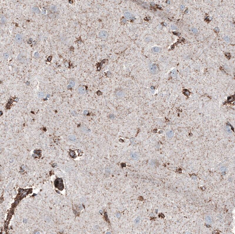 Staining of human cerebral cortex shows  moderate granular cytoplasmic positivity in astrocytes.