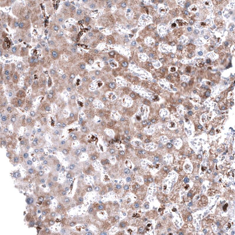 Staining of human liver shows weak cytoplasmic positivity in hepatocytes.