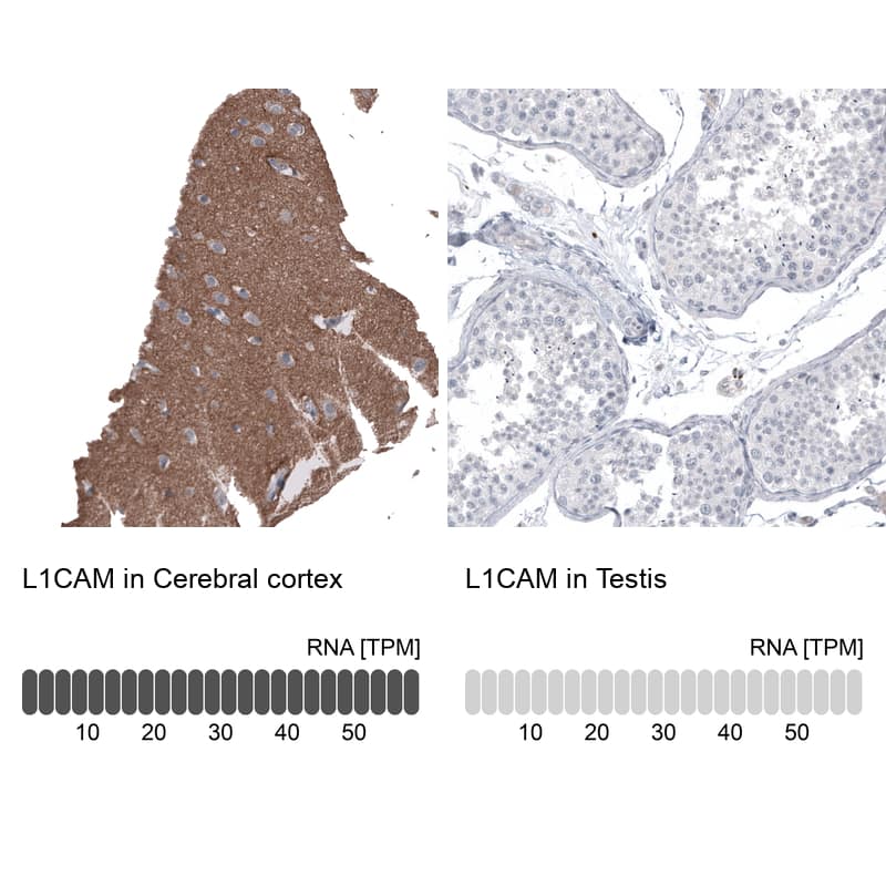 <b>Orthogonal Strategies Validation. </b>Analysis in human cerebral cortex and testis tissues using NBP3-44382 antibody. Corresponding L1CAM RNA-seq data are presented for the same tissues.