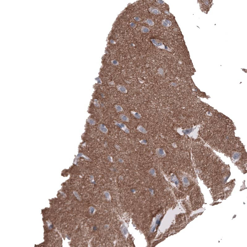 Staining of human cerebral cortex shows moderate positivity in neuropil.