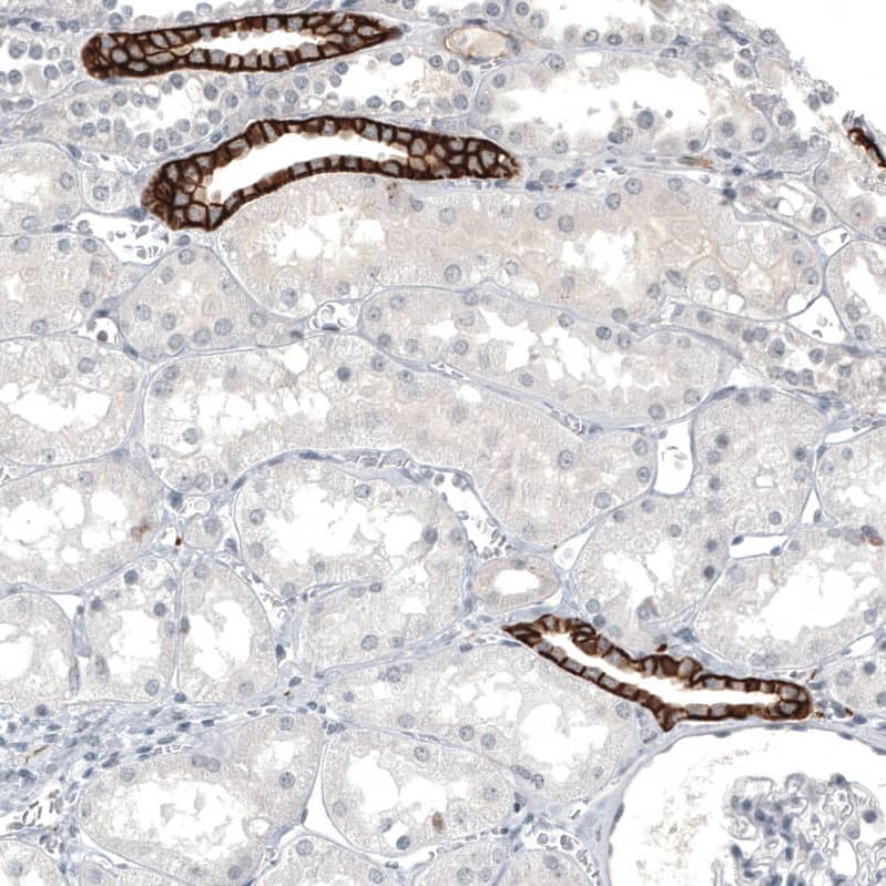 Staining of human kidney shows strong membranous positivity in a subset of cells in tubules.