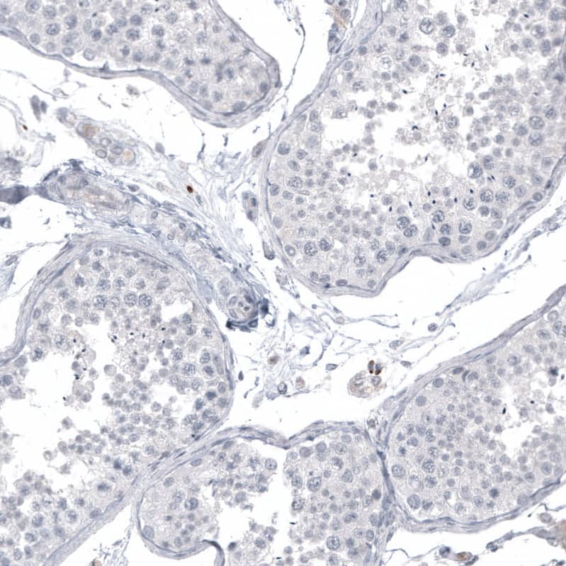 Staining of human testis shows no positivity in cells in seminiferous ducts as expected.