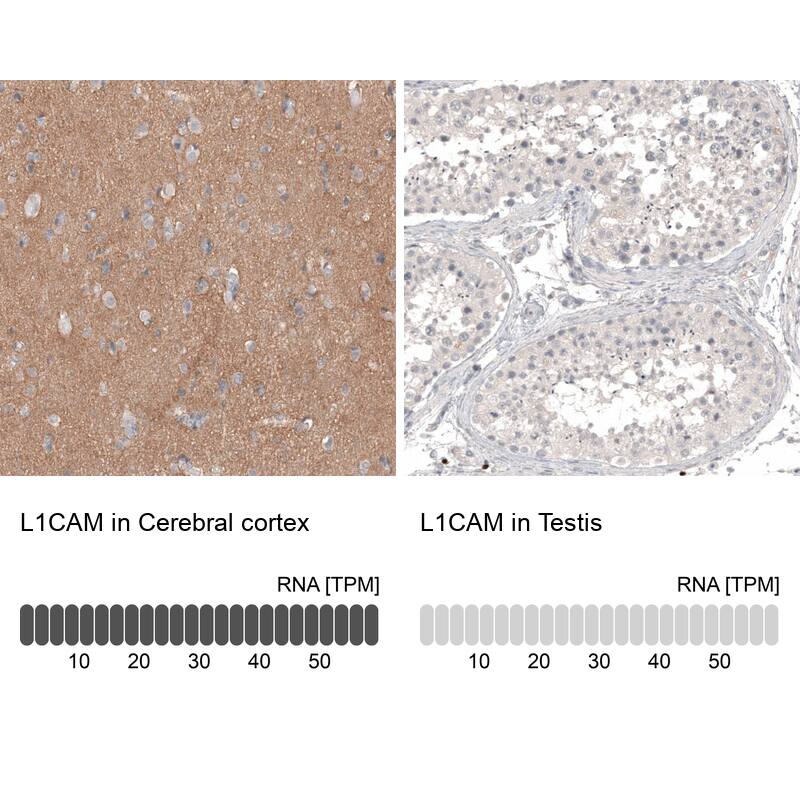Analysis in human cerebral cortex and testis tissues using NBP3-44383 antibody. Corresponding L1CAM RNA-seq data are presented for the same tissues.