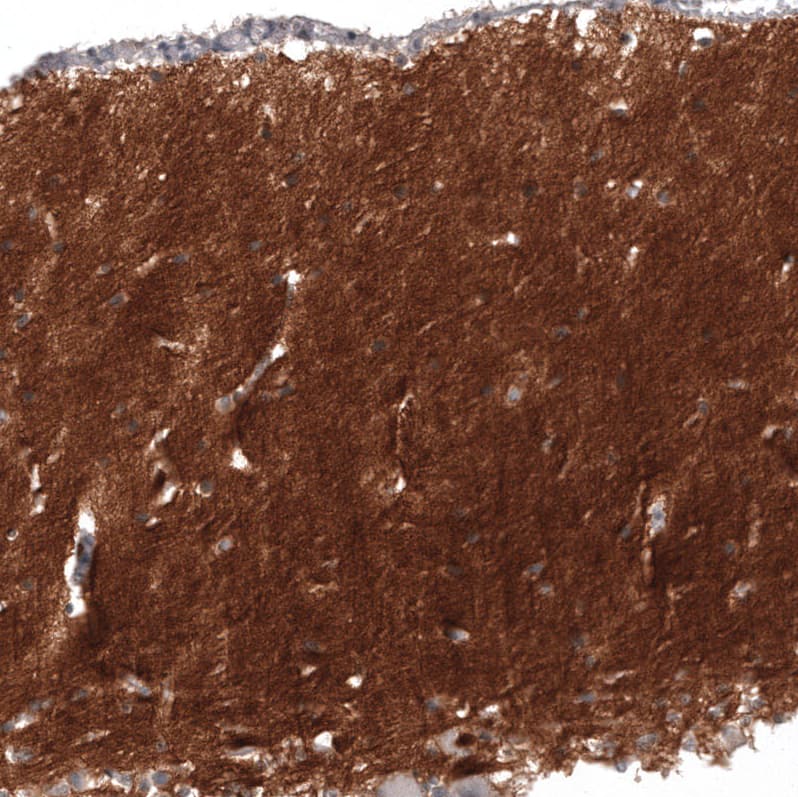 Staining of human cerebellum shows strong positivity in neuropil.