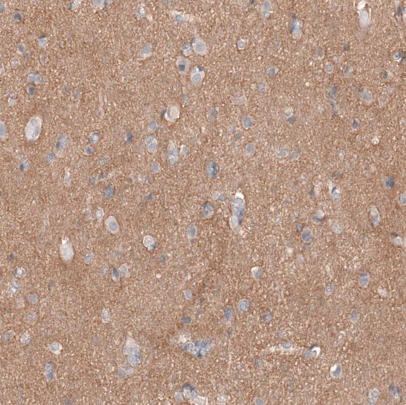 Staining of human cerebral cortex shows moderate positivity in neuropil.