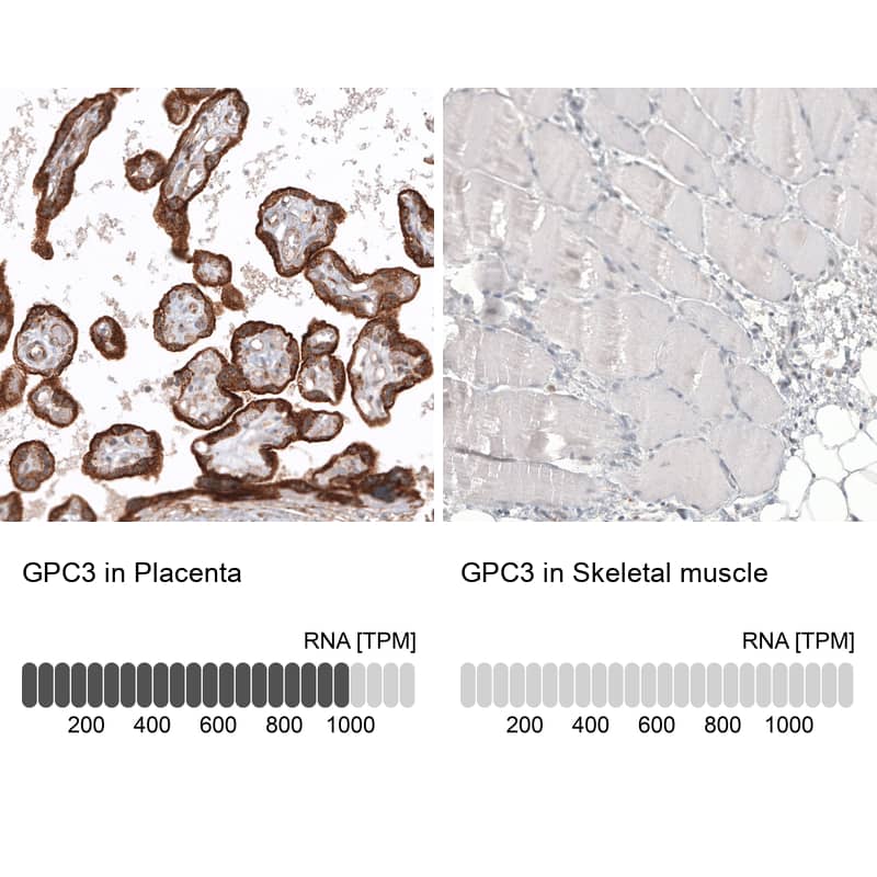 Analysis in human placenta and skeletal muscle tissues using NBP3-44385 antibody. Corresponding Glypican 3 RNA-seq data are presented for the same tissues.
