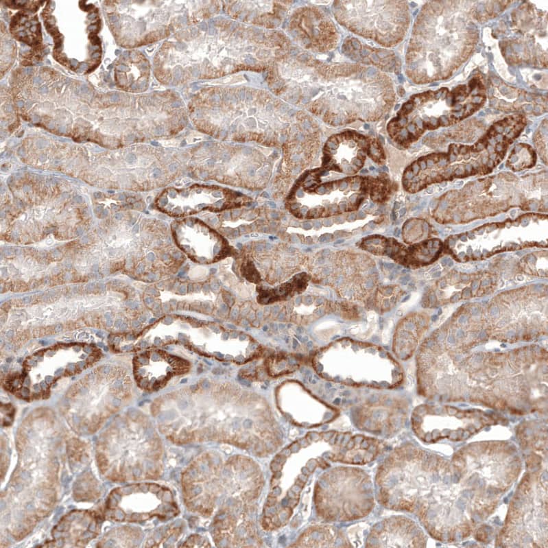 <b>Orthogonal Strategies Validation. </b>Staining of human kidney shows moderate membranous positivity in cells in tubules.