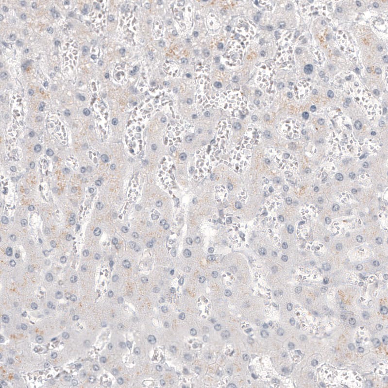 Staining of human liver shows no positivity in hepatocytes as expected.
