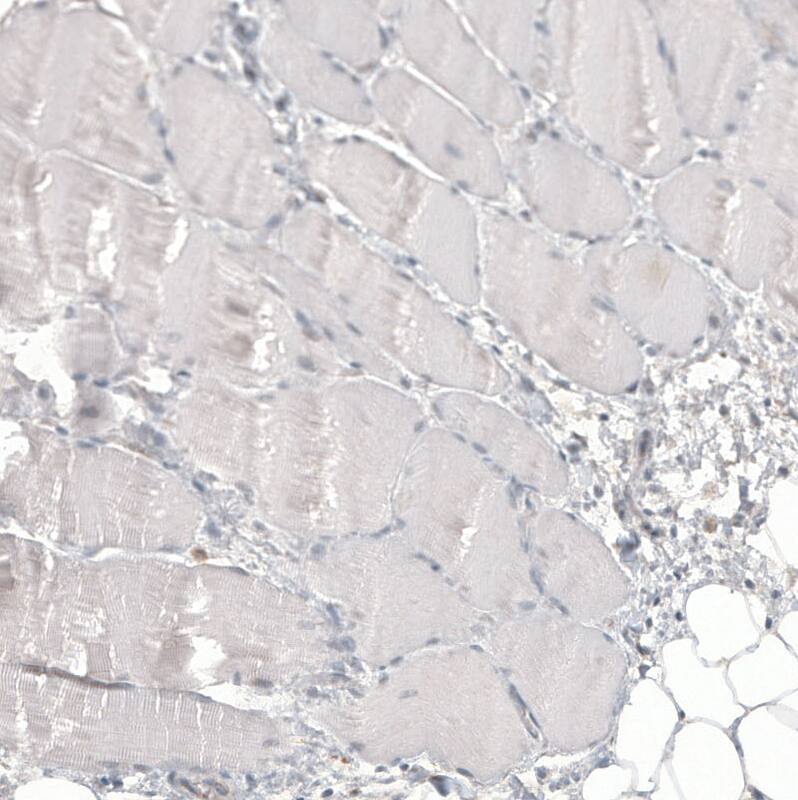 Staining of human skeletal muscle shows no positivity in myocytes as expected.