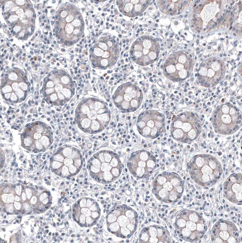 Staining of human rectum shows no positivity in glandular cells as expected.