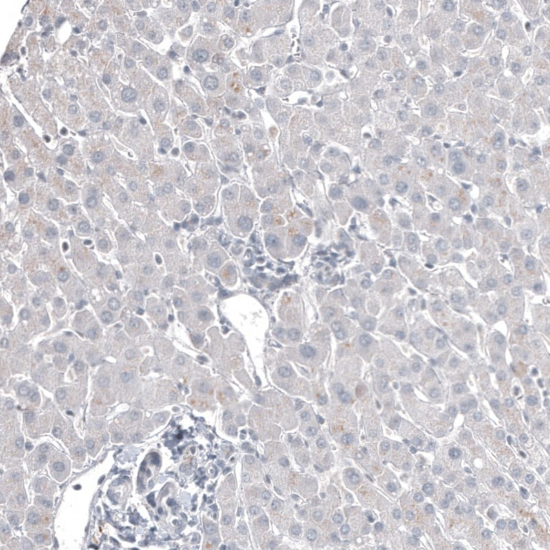 Staining of human liver shows no positivity in hepatocytes as expected.
