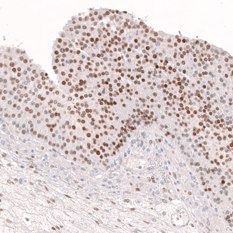 Staining of human ovary shows moderate to strong nuclear positivity in follicle (granulosa) cells.