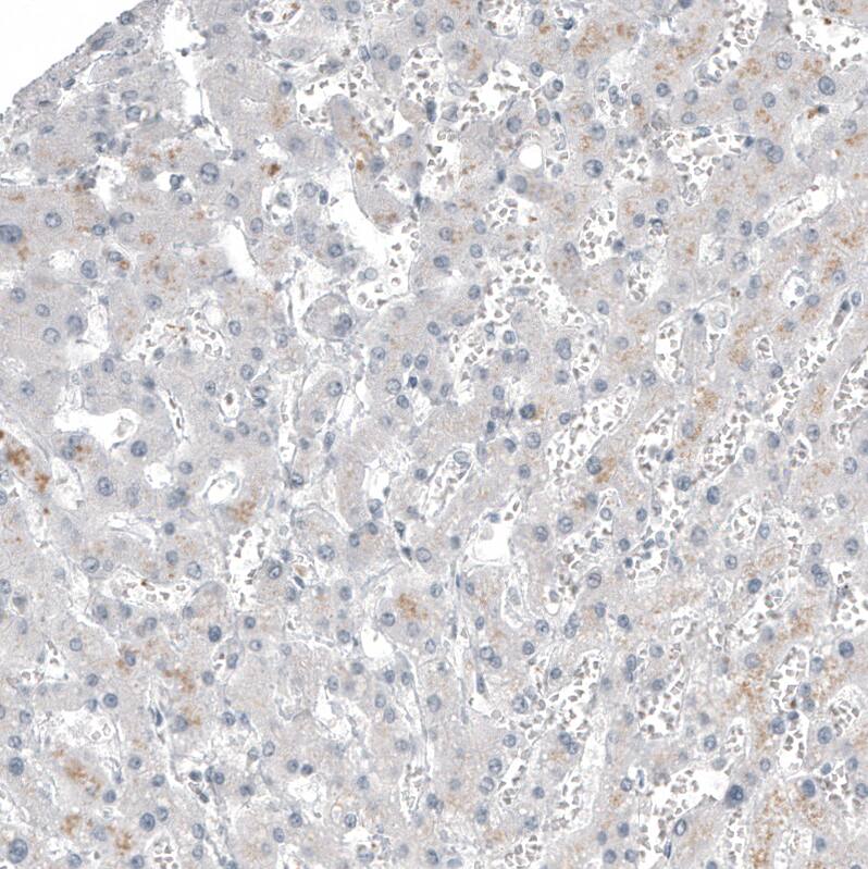 Staining of human liver shows no positivity in hepatocytes as expected.