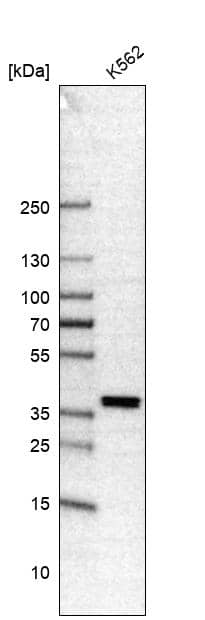 Analysis in human cell line K562.