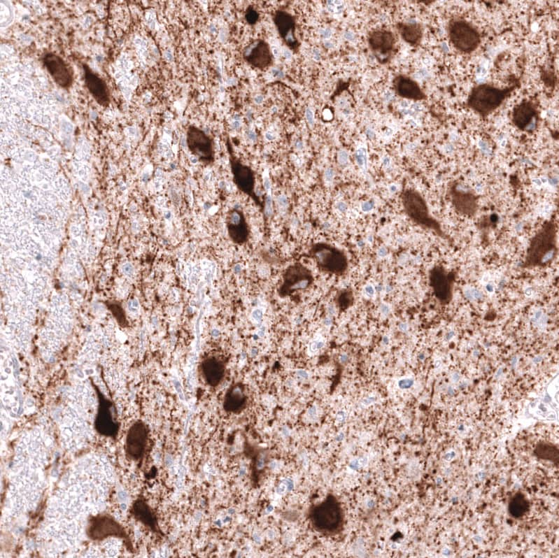 Staining of human dorsal raphe nucleus shows strong cytoplasmic positivity in neurons.