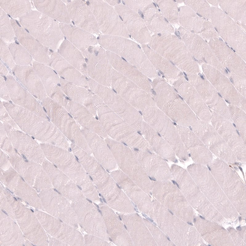 Staining of human skeletal muscle shows no positivity in myocytes as expected.