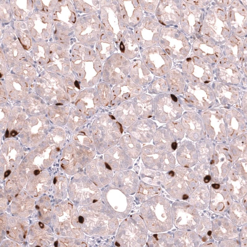Staining of human stomach shows strong cytoplasmic positivity in gastric endocrine cells.