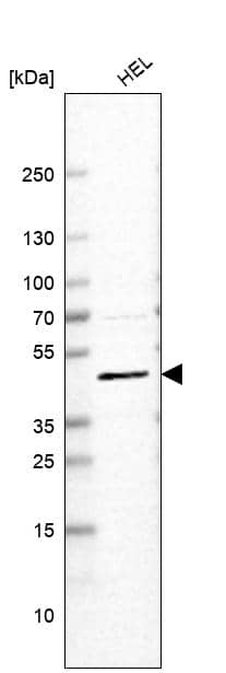 Analysis in human cell line HEL.