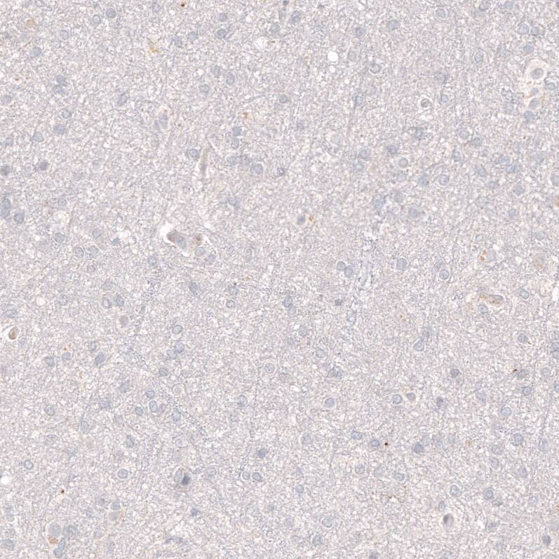 Staining of human cerebral cortex shows no positivity in neurons as expected.