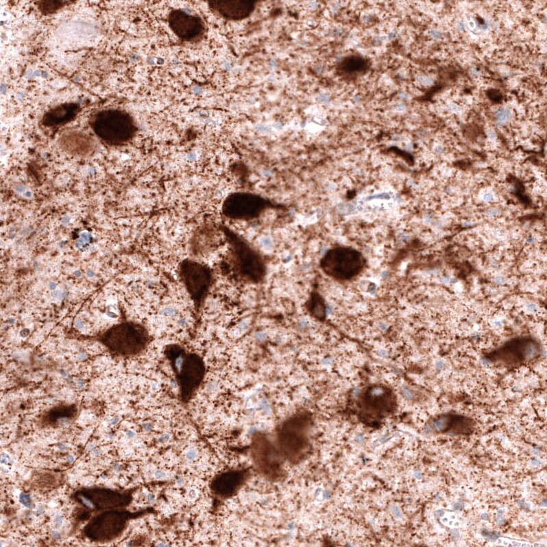 Staining of human dorsal raphe nucleus shows strong cytoplasmic positivity in neurons.