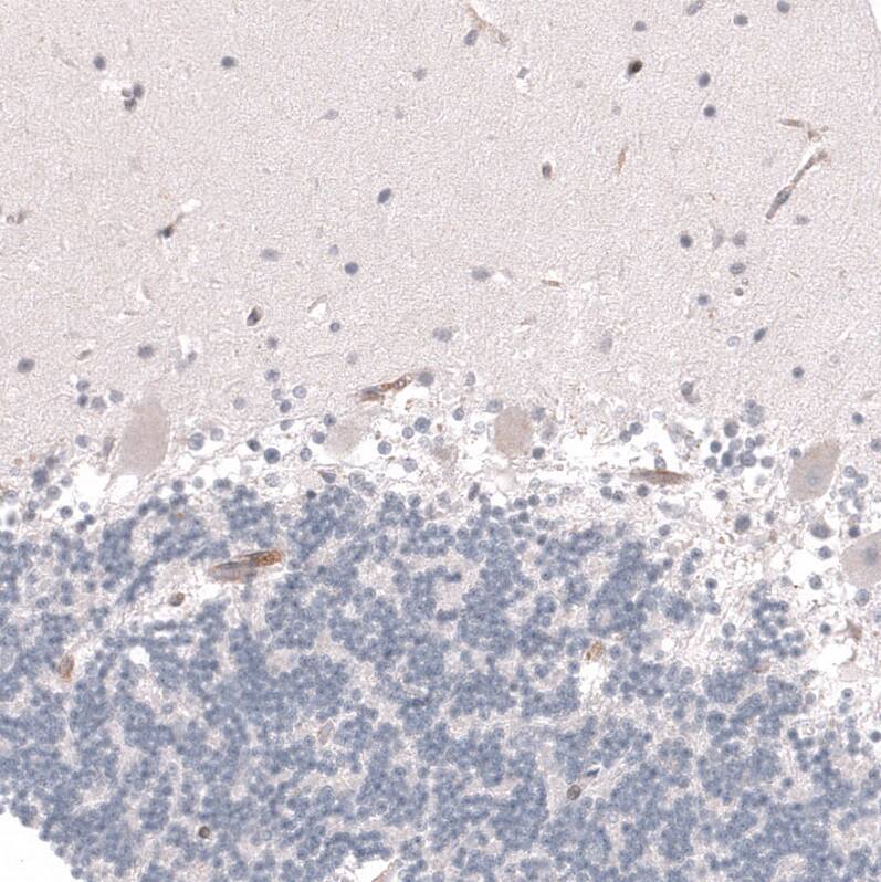 Staining of human cerebellum shows no positivity in Purkinje cells as expected.