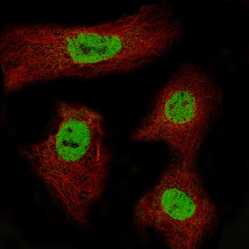 Staining of CACO-2 cells using the Anti-CDX2 monoclonal antibody) .