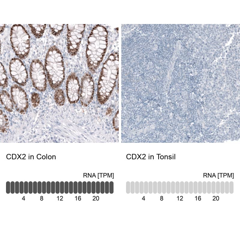 Analysis in human colon and tonsil tissues using NBP3-44392 antibody. Corresponding CDX2 RNA-seq data are presented for the same tissues.