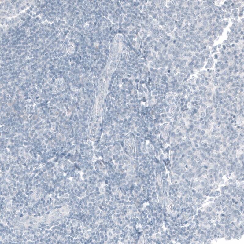 Staining of human tonsil shows no positivity in non-germinal center cells as expected.