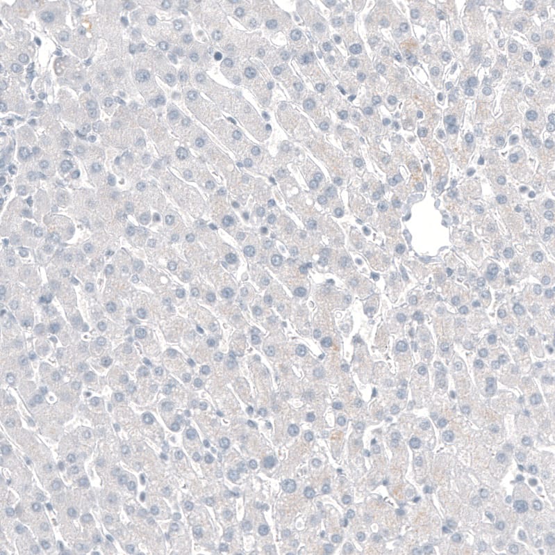 Staining of human liver shows no positivity in hepatocytes as expected.