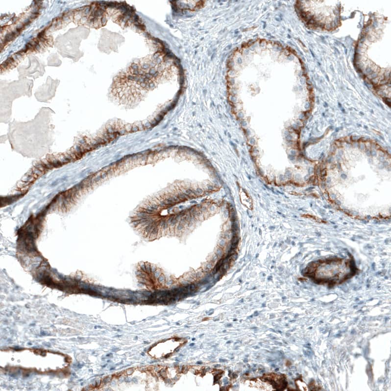 Staining of human prostate shows moderate membranous positivity in glandular cells.