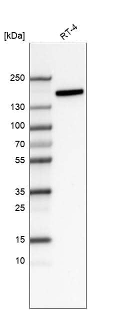 Analysis in human cell line RT-4.
