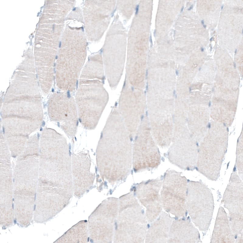 Staining of human skeletal muscle shows no membranous positivity in striated muscle fibers as expected.