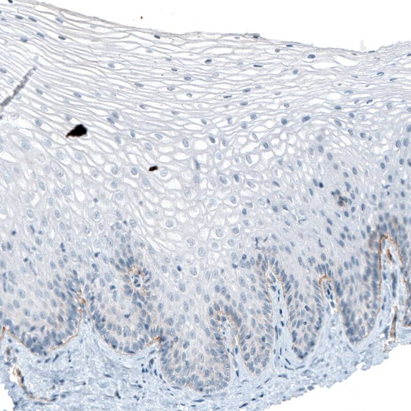 Staining of human uterine cervix shows weak to moderate basement membrane positivity in squamous epithelium.