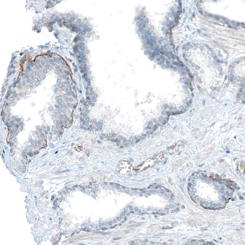 Staining of human prostate shows weak to moderate basement membrane positivity in glandular cells.