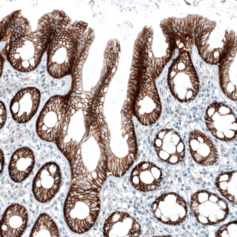 Staining of human colon shows strong membranous positivity in glandular cells.