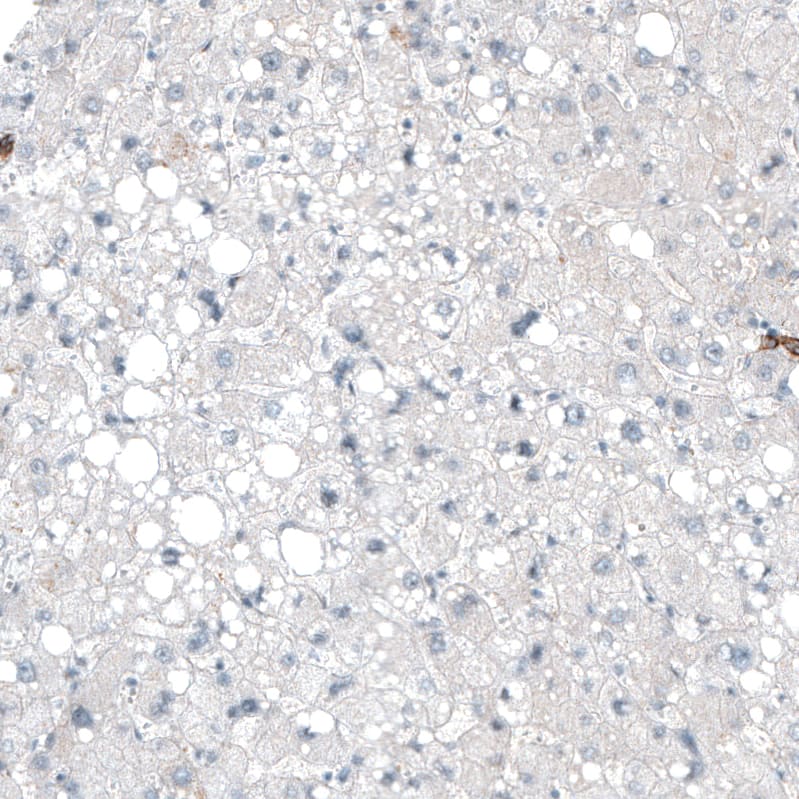 Staining of human liver shows no positivity in hepatocytes as expected.
