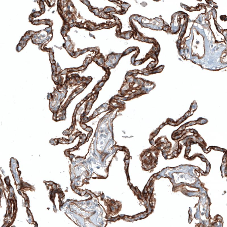 Staining of human lung shows strong membranous positivity in pneumocytes.